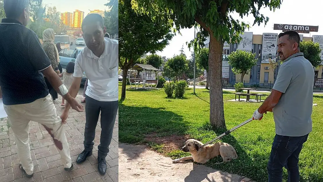 Şanlıurfa'da Bir Kuduz Köpek Vakası Daha! Isırdığı Kişi Karantinaya Alındı