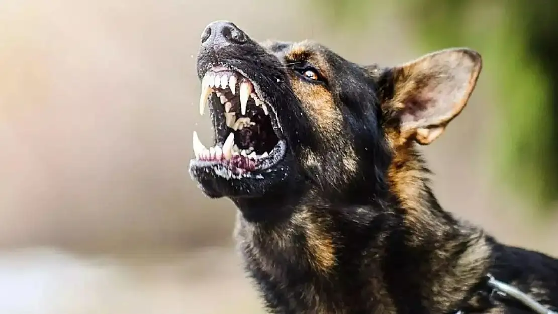 Sokak Köpeği Terörü Bitmek Bilmiyor! Ankara'da Saldırıya Uğrayan Akademisyenin Yüzü ve Bacağı Parçalandı