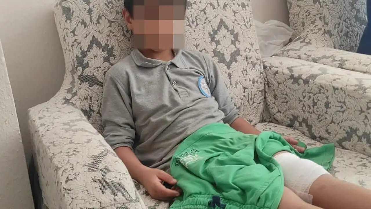 Okul Yolunda Korkunç Saldırı! Sahipsiz Köpek Çocuğa Saldırdı