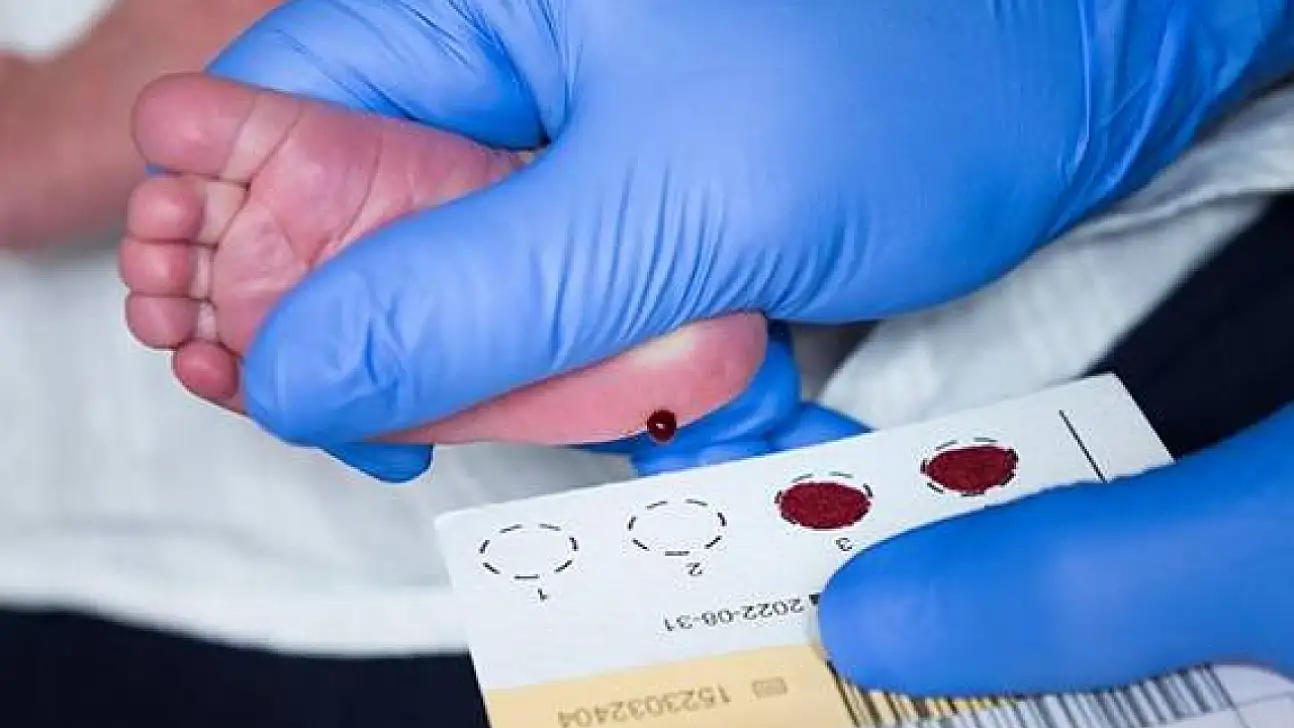 Topuk Kanı Uygulamasının Reddi Önceki Yıllara Göre 5 Kat Arttı