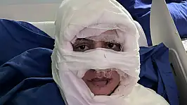 Genç kadın başka bir kadın tarafından ateşe verildi