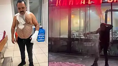 Soğuk havayı test etmek isterken kendini yaktı