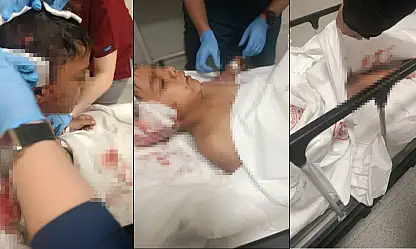 Sokak köpeğinin saldırısına uğrayan çocuk yaralandı