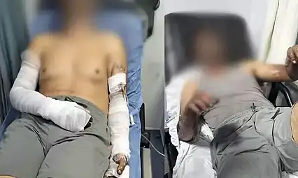 Oto tamirhanesinde patlama 2 işçi yaralandı