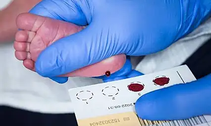 Topuk Kanı Uygulamasının Reddi Önceki Yıllara Göre 5 Kat Arttı