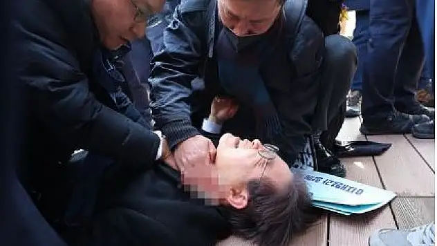 Ana Muhalefet Liderine Bıçaklı Saldırı