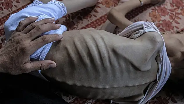 Birleşmiş Milletler Gazze'de ilk kez resmi olarak kıtlık ilan edildiğini duyurdu