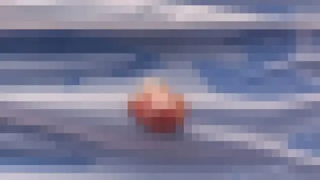 Çocuğun parmağı koptu, ders devam etti!