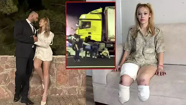 Evlilik yıl dönümü kabusa döndü: Bacaklarını kaybetti!