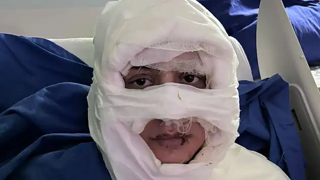 Genç kadın başka bir kadın tarafından ateşe verildi