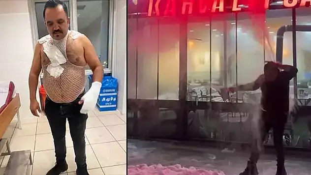 Soğuk havayı test etmek isterken kendini yaktı