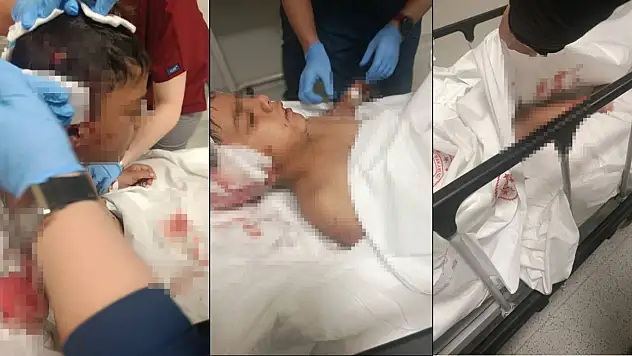 Sokak köpeğinin saldırısına uğrayan çocuk yaralandı