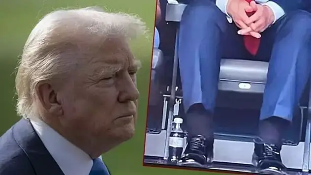 Trump'ın bacaklarındaki şişliklerin sebebi belli oldu