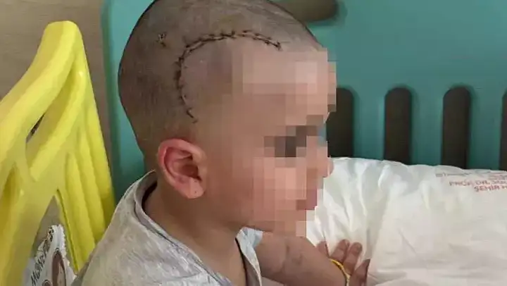Anaokulunda korkunç kaza! Küçük çocuk ölümden döndü