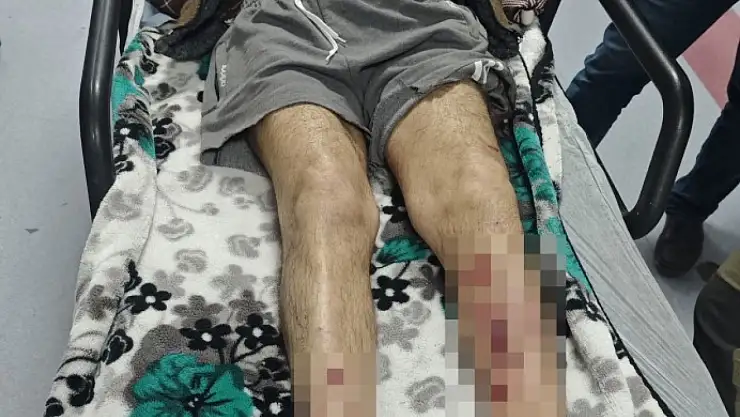 Alzheimer hastası adam köpeklerin saldırısına uğradı