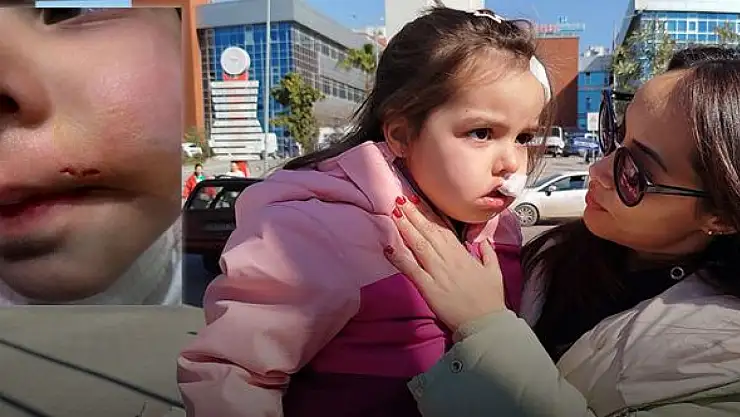 AVM'deki Sahipsiz Köpek 3 Yaşındaki Çocuğa Saldırdı