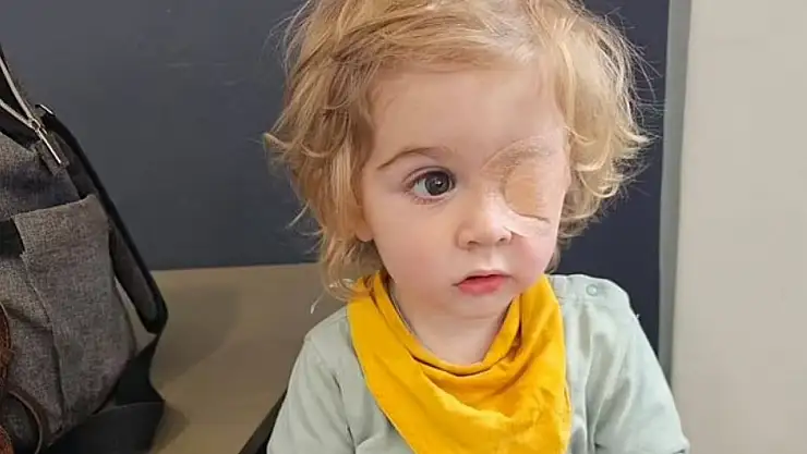 Bir öpücük yüzünden sol gözünü kaybetti