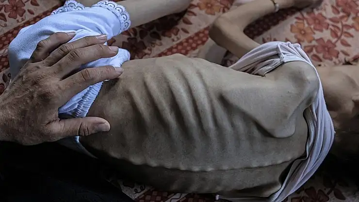 Birleşmiş Milletler Gazze'de ilk kez resmi olarak kıtlık ilan edildiğini duyurdu