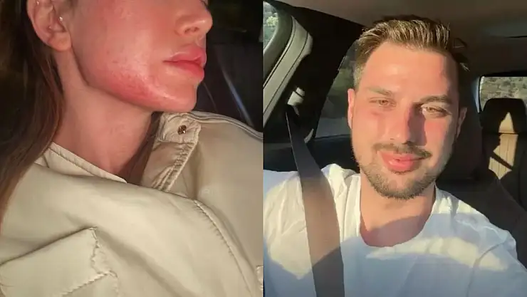 Danla Biliç'in Darp Edildiği Görüntüler Ortaya Çıktı! Danla Biliç'in Eski Sevgilisi Berk Çetin Kimdir?