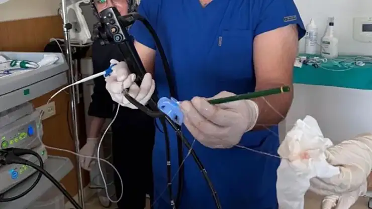 Doktorları şaşkına çeviren vaka: Midesinden kalem çıkarttılar