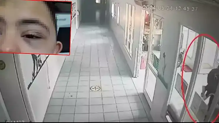 Down Sendromlu Çoçuğa Şiddetin Cezası 12 Bin TL!