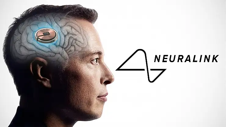 Elon Musk'ın şirketi Neuralink ilk kez bir insanın beynine çip yerleştirdi
