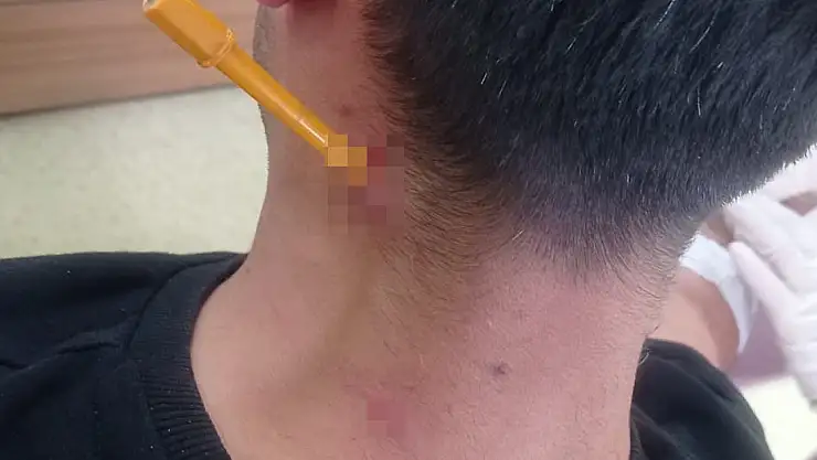 Esenyurt'ta Feci Kavga! Boynuna Tornavida Sapladı