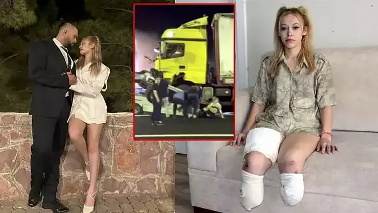 Evlilik yıl dönümü kabusa döndü: Bacaklarını kaybetti!