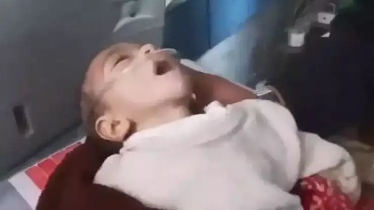 Filistin Sağlık Bakanlığı: 15 Çocuk Açlıktan Öldü