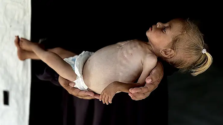 Gazze'de açlıktan ölümler artıyor!