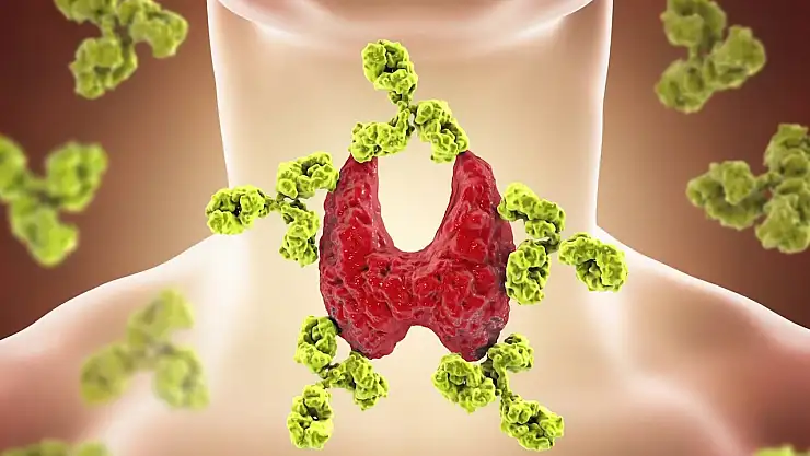 Haşimato Hastalığı Nedir? Haşimato Tedavi Edilebilir mi?