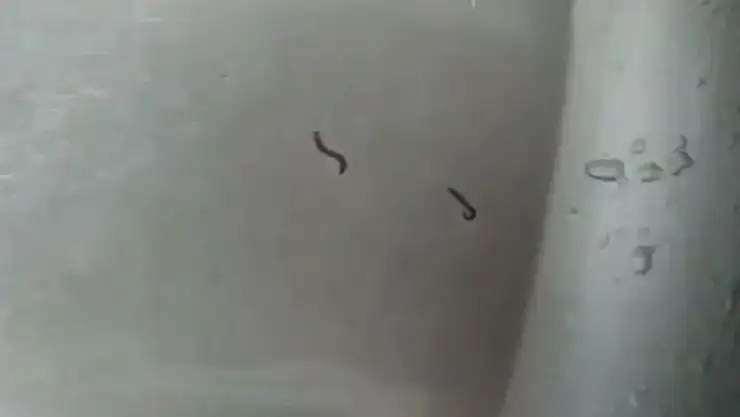 İçme suyundan kurtlar çıktı