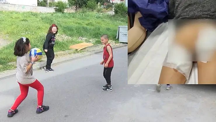 İstanbul'da Sokak Köpeği Dehşeti 7 Yaşındaki Çocuğa 30 Dikiş Atıldı