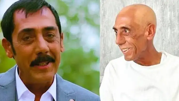 Kanser tedavisi gören Ankaralı Turgut hayatını kaybetti!