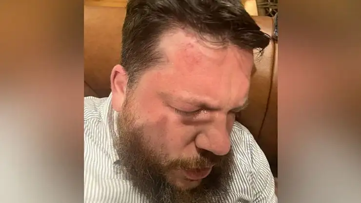 Navalny'nin Arkadaşına Saldıran 2 Kişi Polonya'da Yakalandı