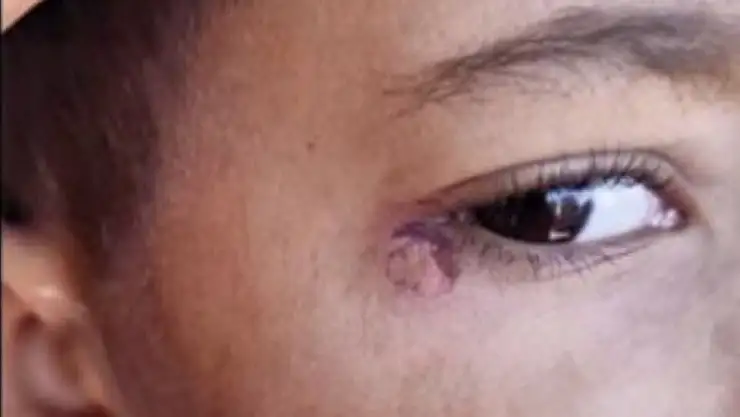 Öğrencinin yüzünde sigara söndürdü, tutuklandı!