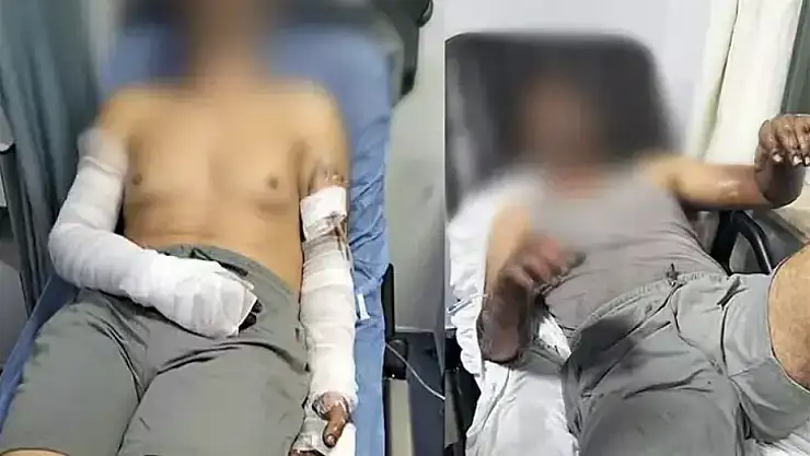 Oto tamirhanesinde patlama 2 işçi yaralandı