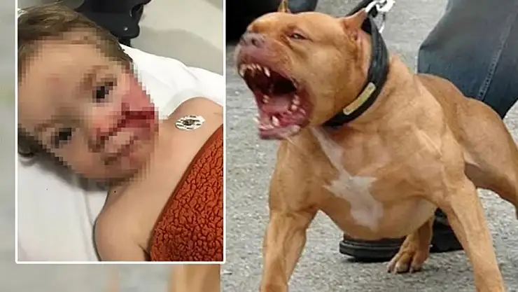 pitbull Dehşeti Çocuğun Yüzü Paramparça Oldu