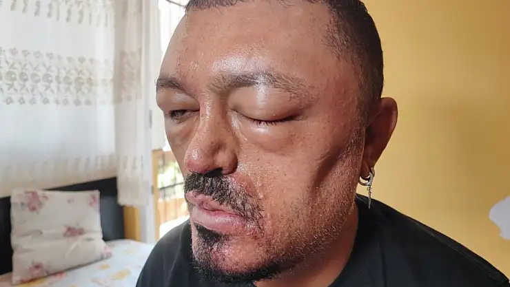 Saç siyahlatan şampuan kör edecekti!