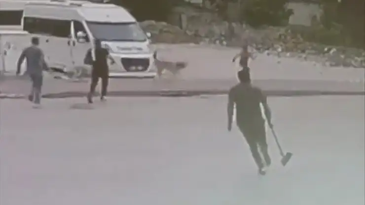 Sokak köpekleri çocuğa saldırdı