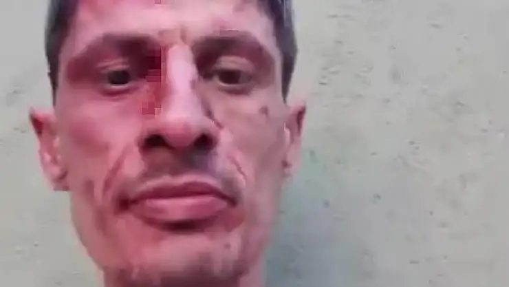 Sosyal Medya Canlı Yayınında Eniştesini Bıçakladı