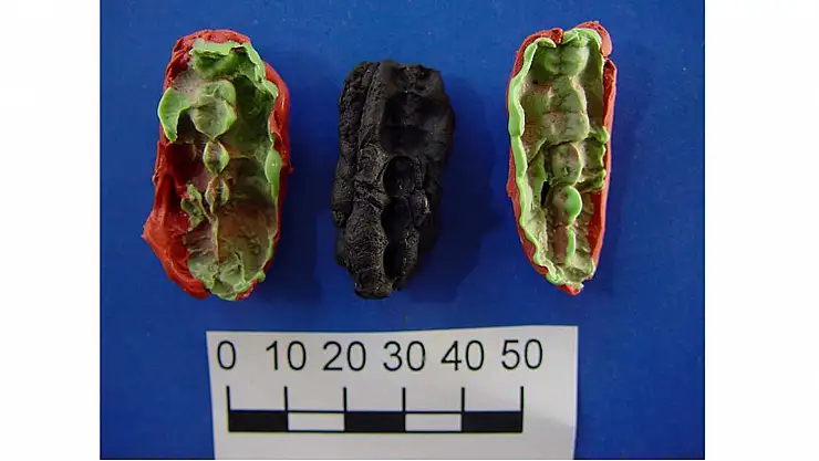 Taş devrinden kalma sakızdan, dönemin hastalıkları ve beslenme şekilleri keşfedildi