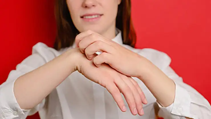 Uyuz Vakaları Arttı, Uzmanlar Salgına Karşı Teyakkuzda