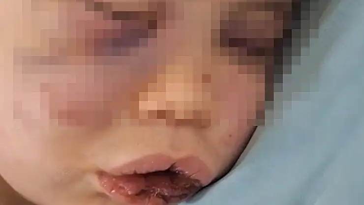 Vahşeti yaşayan 2 yaşındaki bebek hastanelik oldu