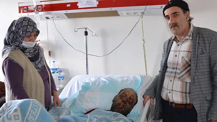 Yağmur Ormanlarında Yaşayanlarda Milyonda 2 Görülen Hastalık, Yüzünü Tanınmaz Hale Getirdi