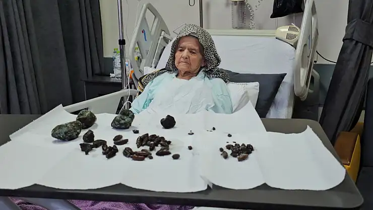 Yaşlı Kadının Mide Ve Bağırsaklarından Çıkanlar Görenleri Şok Etti