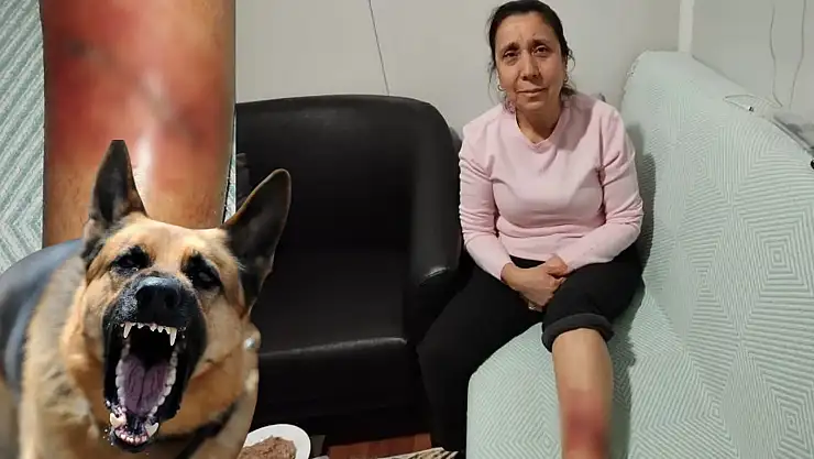 Yine Bir Sokak Köpeği Saldırısı