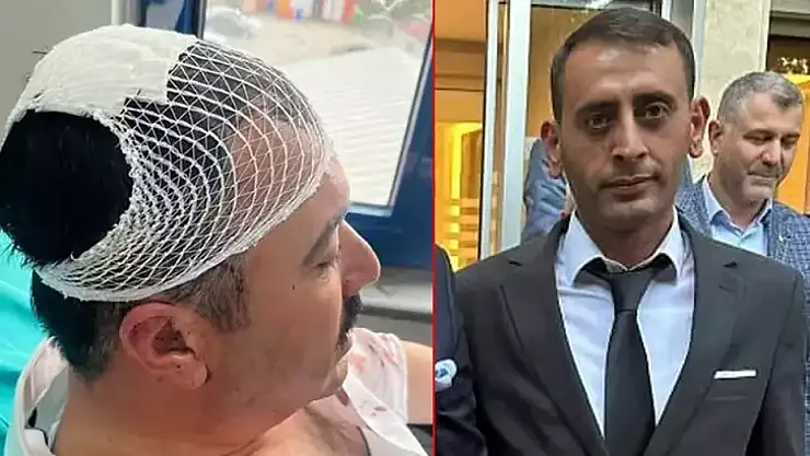 YRP'li İl Başkan Yardımcısı, Belediye Başkan Yardımcısı'nı şekerlikle başına vurarak yaraladı