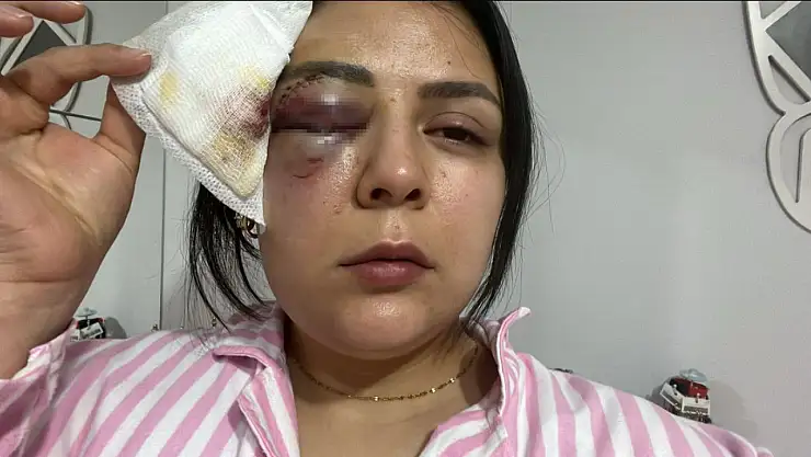 Yürürken saldırıya uğrayan genç kız dehşet anlarını anlattı! Zanlı tekrar gözaltına alındı