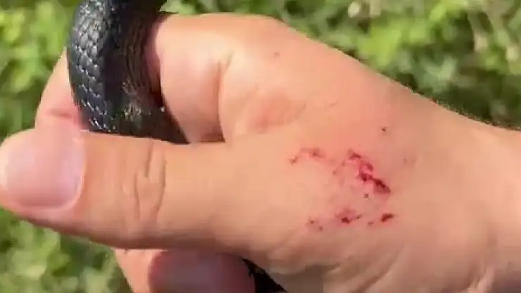 Zararsız olduğunu ispatlamak yakaladığı yılana kendini ısırttı